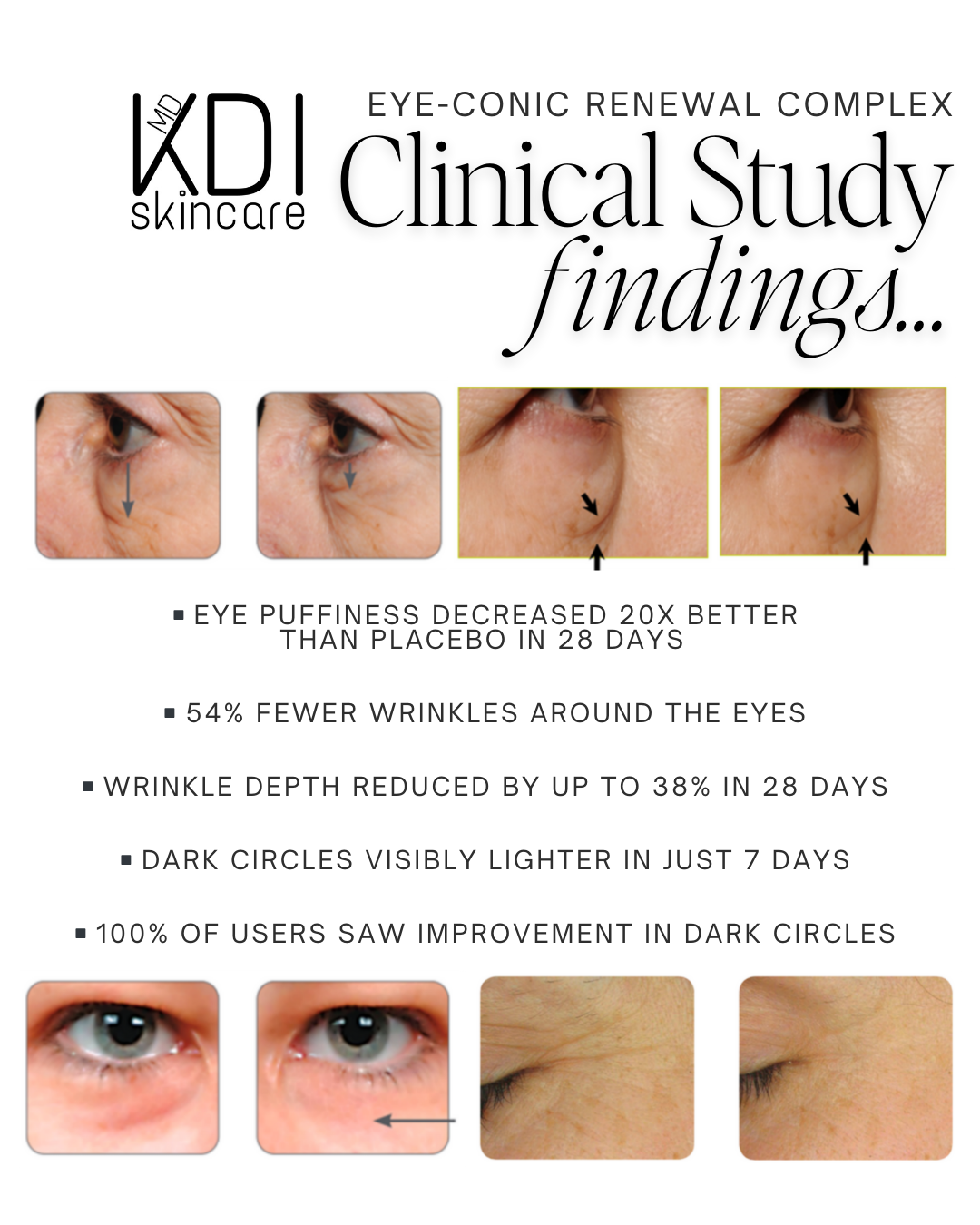 Eye-conic Renewal Complex