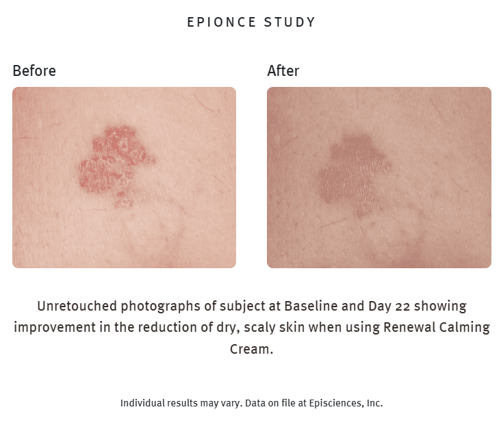 Renewal Calming Cream